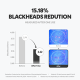 Hydro Boost Enzyme Cleansing Balm